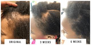 In this video i'll share my 6 months of hair growth journey. How To Use Rice Water To Grow Your Child S Natural Hair
