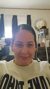 William Mattar Stretcher