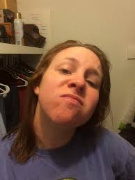 Why do women lips change during pregnancy? Coz I don't understand