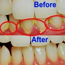 Klinik pergigian selayang baru is a dental clinic in batu caves, selangor that serves your dental needs at a very affordable fee! Klinik Pergigian Ve Care Dental Selayang Dental Clinic In Batu Caves