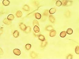 Image result for Ficus amadiensis