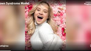 Almost all down syndrome cases result from complete trisomy 21. Latina Model With Down Syndrome Proves There Are No Limits After Modeling At Nyfw Wpec