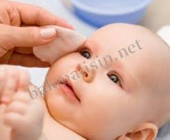 Cocuklarda Goz Capaklanmasi Capaklanma Belirtileri Bebeklerde Goz Capaklanmasi Nedenleri Bebeklerde Goz Capaklanmasi Tedavisi Goz C Baby Face Children Baby