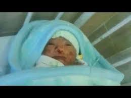 10 Day Old Baby Dies After Being Bitten By Rats In Hospital In Ap