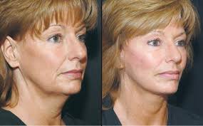 Dr.Hussein Hashim added a new photo.