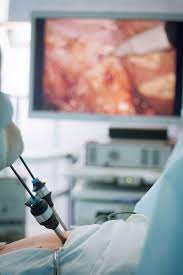 Fachklinik Fur Gallenblasenchirurgie Gallensteinleiden In Munchen