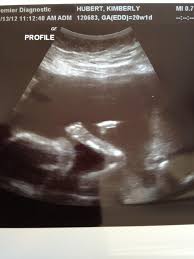 kimberly hubert (@khubert143)