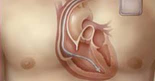 Είναι δηλαδή η θυσία κάποιων άλλων αγαθών που θα μπορούσαν να παραχθούν με. Bhmatodotes Sth Mish Timh E Thessalia Gr