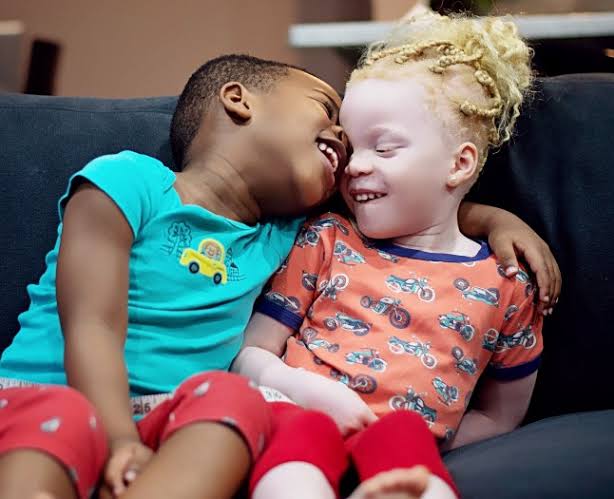 Mum of black and white twins say people do not believe they are her children  | Metro News