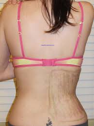 Pin On Health