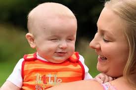 Birtley boy Lucas born with rare eye defect