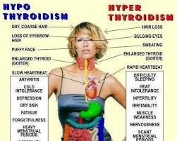 Thyroid And Fatigue Everything You Need To Know Thyroid Disease Thyroid Health