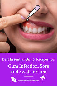 Pin On Essential Oils For Beginners
