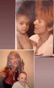 Although the exact cause of liver cancer is unknown, there are a number of genetic conditions that are associated with an increased risk for developing hepatoblastoma. David Bowie Passed Away 4 Years Ago From Liver Cancer But His Daughter Keeps His Memory Alive With Sweet Photo Of Her Dad Survivornet