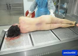 CHINESE FEMALE AUTOPSY] EXAMINATION CORPS OF MURDERED WOMAN | theYNC