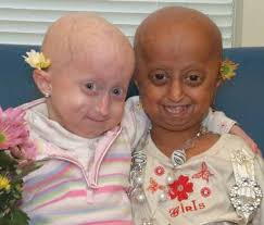Groundbreaking Studies Identify New Potential Drug Treatment, Strengthen  Progeria-Aging Link