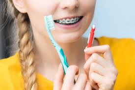 Brushing your teeth is a habit you've had ingrained since early childhood, so it's fitting that people sometimes compare other good routines to dental hygiene. What Happens If You Have Braces And Don T Brush Your Teeth