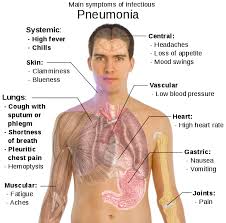 Bayi 13 bulan meninggal dunia akibat jangkitan kuman di kanak kanak alami jangkitan kuman pada paru paru akibat kerap hidu asap rokok bumbumcak my. Cara Atasi Jangkitan Kuman Paru Paru Pneumonia Dengan Selamat Dan Berkesan