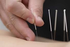 Pharmacy is a profession in canada; 19 Top Acupuncture Schools In The World Salary