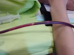 No pricing info available in japan. Ezlife Ozone Therapy Centre Home Facebook