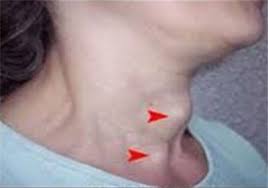 Image result for ‫رژیم غذایی در کم کاری تیروئید‬‎