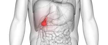 ارتجاع العصارة الصفراوية ويب طب