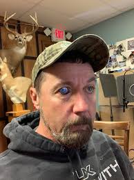 Well I couldn't go to my doctor cause Obama care wouldn't cover it so I had  to use a foreign guy to fix my eye. He got the red out but it