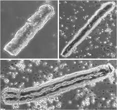 Image result for Urinary Cast