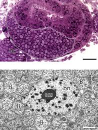 Image result for Buchnera