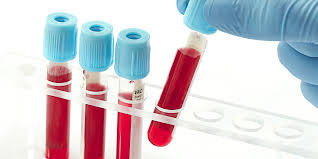 Image result for blood testing pictures for facebook