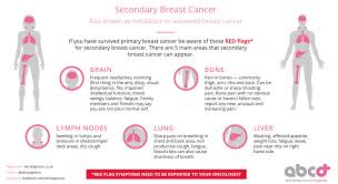 Pancreatic cancer is especially aggressive and its location makes it easy for it to spread into i know i am not a doctor but i can't get over how we can not at least try. What Every Woman Who S Had Breast Cancer Should Know Total Health
