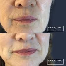 Jack Zamora MD Cosmetic Surgery and Aesthetics