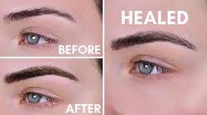 Gently wash your eyebrows every morning and night with water and the antibacterial soap, cetaphil provided (you. Microblading Experience Before After 10 Day Healing Process Youtube