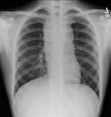 Pin On Radiology