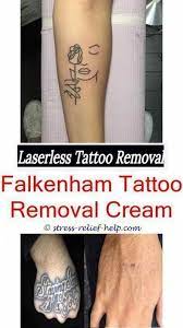 How can i get a tattoo removed? Excision Tattoo Removal How Long To Keep Bandage On After Laser Tattoo Removal Bandag Diy Tattoo Tatowierungen Tochter Tattoos
