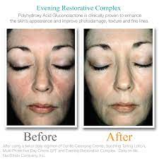 There are two steps to this peel: I Am The Makeup Junkie Review Exuviance Evening Restorative Complex Gotitfree Exuviance Eveningrestorativecomplex Neostrata