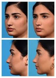Perfect nose: Discover 38 nose ideas