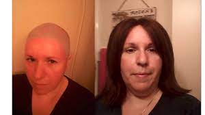 Female Hair Loss Solution Hair Replacement System For Women Youtube