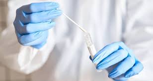 Covid 19 Contaminations Taux De Positivite Ou En Est L Epidemie Dans Le Lauragais Voix Du Midi Lauragais