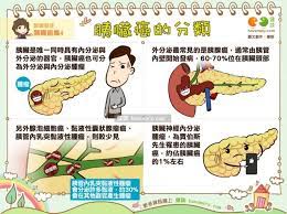 胰子 (yízi) (informal, of a domestic animal). æ–°ç‡Ÿå¤§å®‰è—¥å±€ èƒ°è‡Ÿç™Œèƒ°è‡Ÿç™Œæ—©æœŸå¤§å¤šä¸æ˜Žé¡¯ä¹Ÿä¸ç‰¹æ®Š é›£ä»¥å¯Ÿè¦º è…«ç˜¤å¤§åˆ°ä¸€å®šç¨‹åº¦æ™‚ æ‰æœƒæœ‰ç—‡ç‹€ Facebook