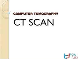 Computer Tomography Ct Scan