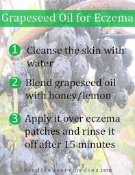 Grapeseed Oil For Eczema Oils For Eczema Eczema Natural Anti Aging Skin Care