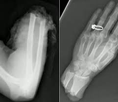 Amazing X Rays Photos Yikes Craziest X Rays X Ray Radiology Radiology Humor