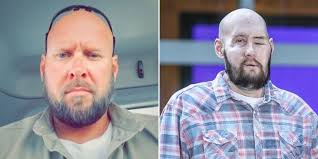 Un hombre recibió el primer trasplante de ojo completo en el mundo