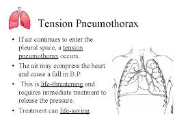 Pulmonary fibrosis occurs with an overgrowth of tissue in the lungs and may lead to a pneumothorax. Penetrating Chest Wounds Pneumothorax Tension Pneumothorax And Hemothorax