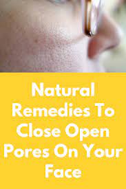 You will notice the improvement immediately. Natural Remedies To Close Open Pores On Your Face People With Oily Skin Are More Likely To Have Open Pores Ho Open Pores On Face How To Close Pores Face Pores