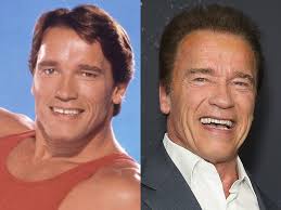 How to get rid of gaps in your teeth without braces. Celebrities Who Have Closed Their Gap Teeth