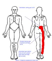 Lumbar Disc Herniation With Radiculopathy A Case Study