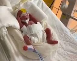 Rekortmen anne, ultrason sonuçlarına göre 8 bebek beklerken, 10 bebek dünyaya getirmiş olmanın kendisi için de inanması güç. 4t9jlim6cdvrxm