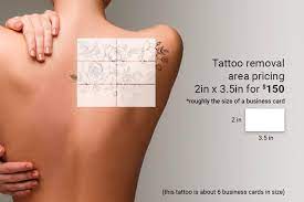 The picosure (great for greens/blues) and an nd: Tattoo Removal Seattle Tattoo Removal Bellevue